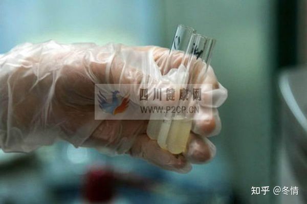 hiv到底是怎么洗精的呢(图3)