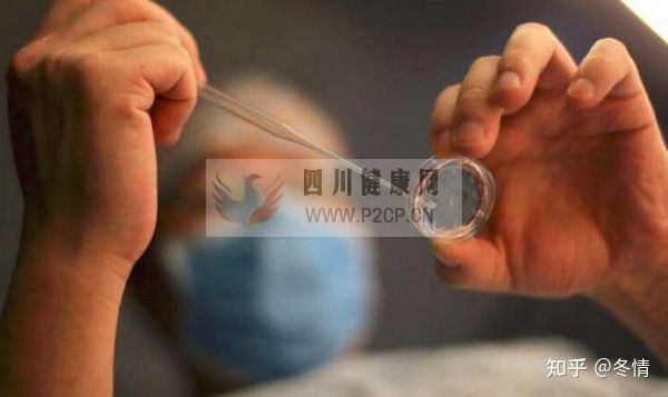 hiv到底是怎么洗精的呢(图5)