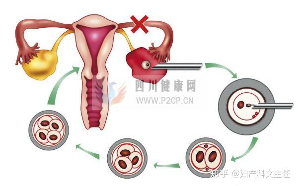 促排期间,这么做有利于提高试管成功率(图2)