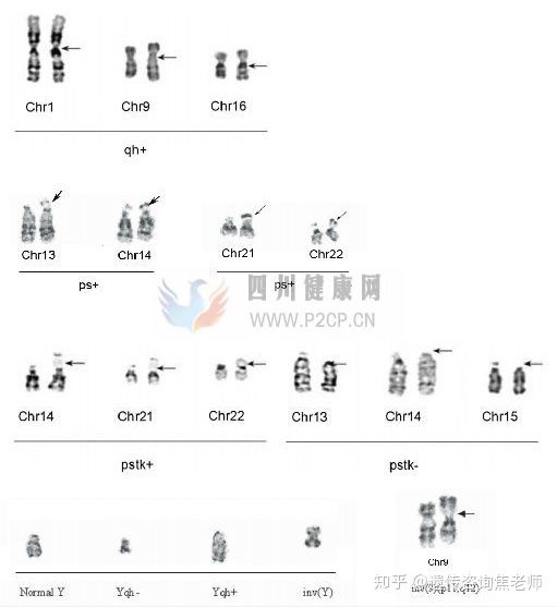 这几种染色体异常说明你没事(图1)