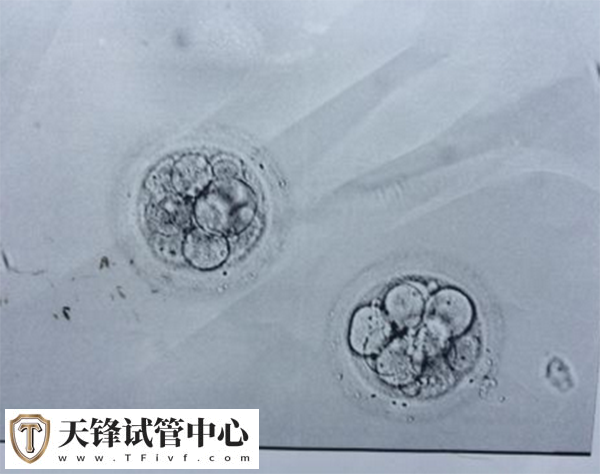 囊胚解冻失败与质量有关系