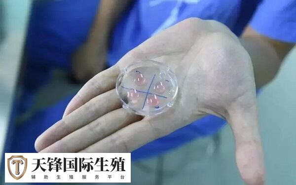 试管婴儿有哪些促排方案