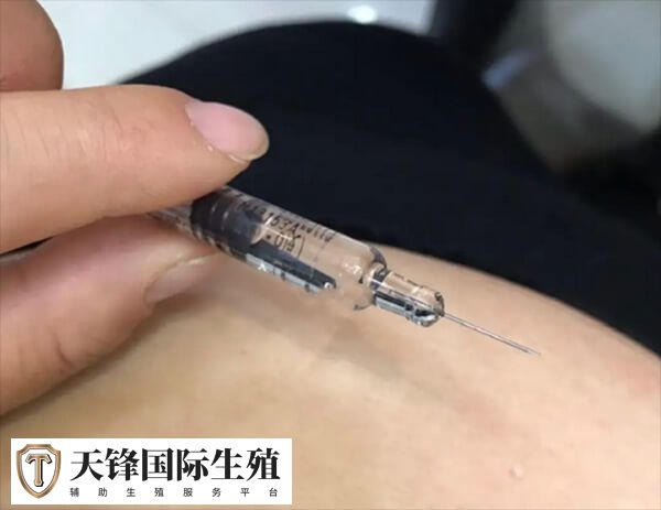 试管婴儿有哪些促排方案(图2) 长方案需要降调