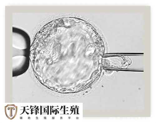 试管微刺激方案为什么不能移植鲜胚？