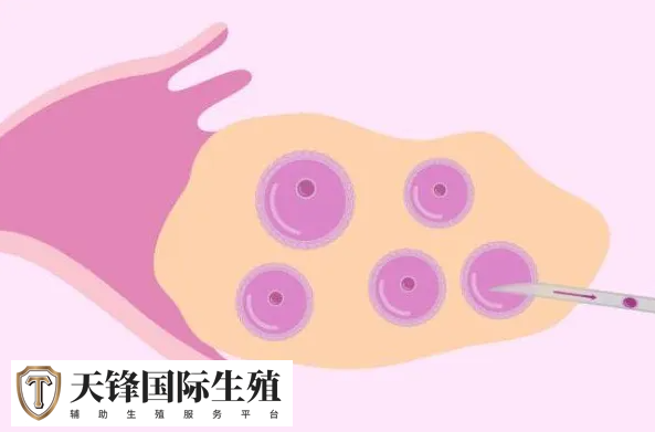 试管微刺激方案为什么不能移植鲜胚?(图2) 341eb49861fc45e69fedf5b7aba218a5_1742100096834359.png