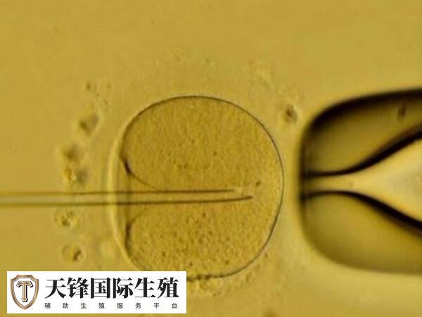 试管一对龙凤胎多少钱