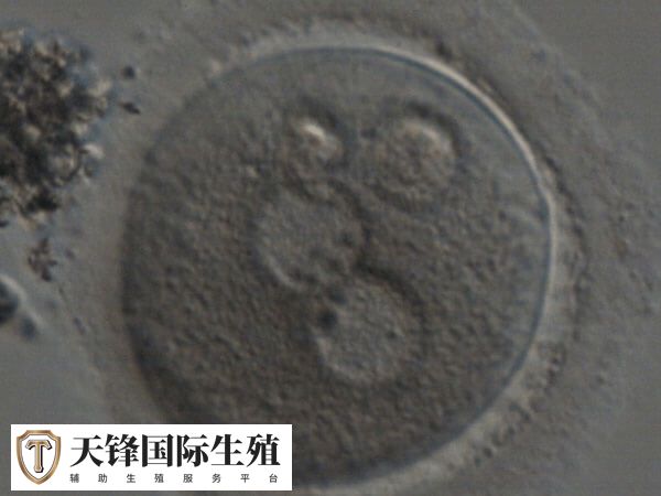 试管一代转二代会不会浪费卵子
